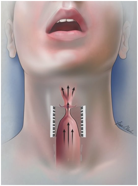 Почему происходит кровотечение из горла: причины и симптомы